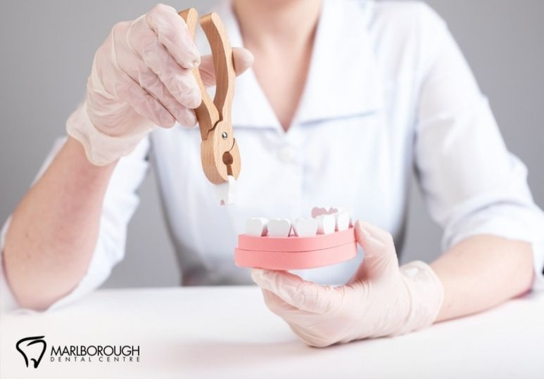 5 Signs Your Wisdom Teeth Need to Be Removed (Before They Cause Problems) 